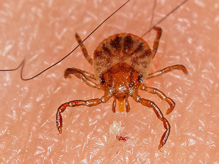 Descubra o que é a febre maculosa e quais são os sintomas dessa doença